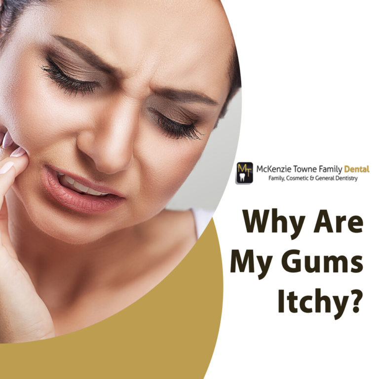 why-are-my-gums-itchy-mckenzie-towne-family-dental